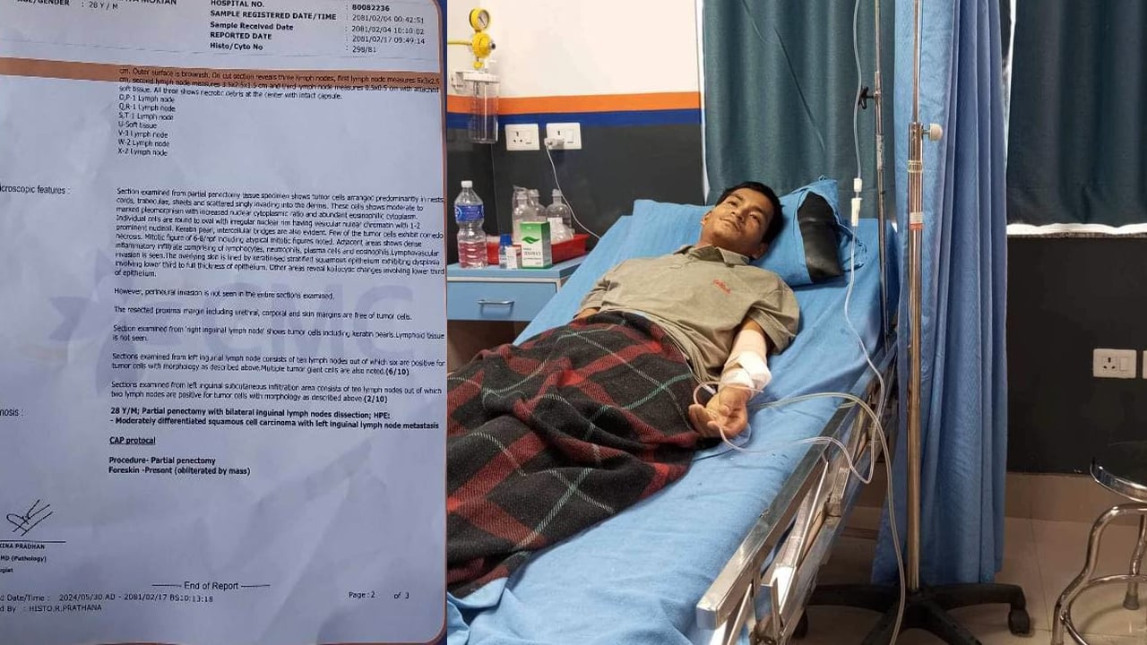 हेटौंडा ११ का क्यान्सर पीडित अभय मोक्तानद्वारा सहयोगको अपिल